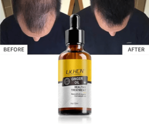 LICHEN GINGER SERUM 30ml