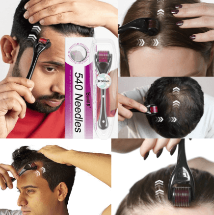 7 Days Serum  with Derma Roller 