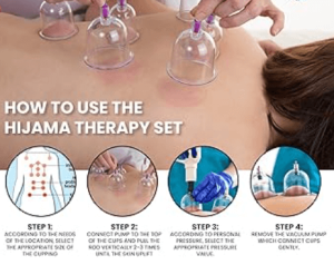 Hijama Kit 12 Pcs Cups