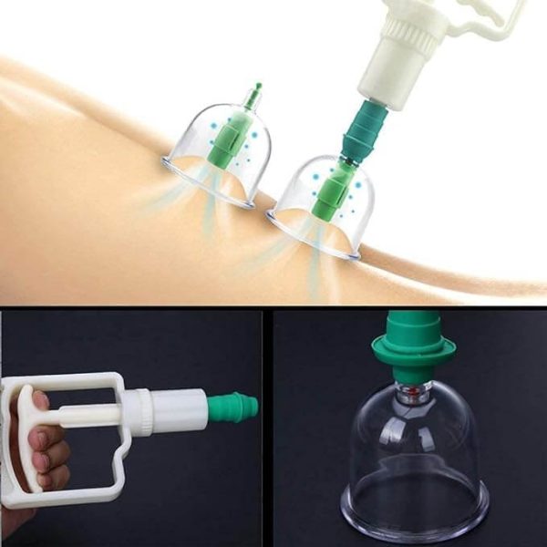 Hijama Kit 12 Pcs Cups