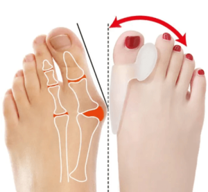 Pack Of 4 Pairs Silicone Gel Foot Fingers Hole